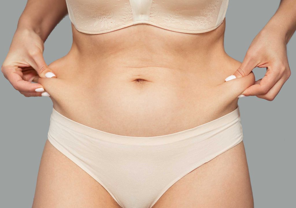 ¿Queda la piel colgada después de la criolipólisis?