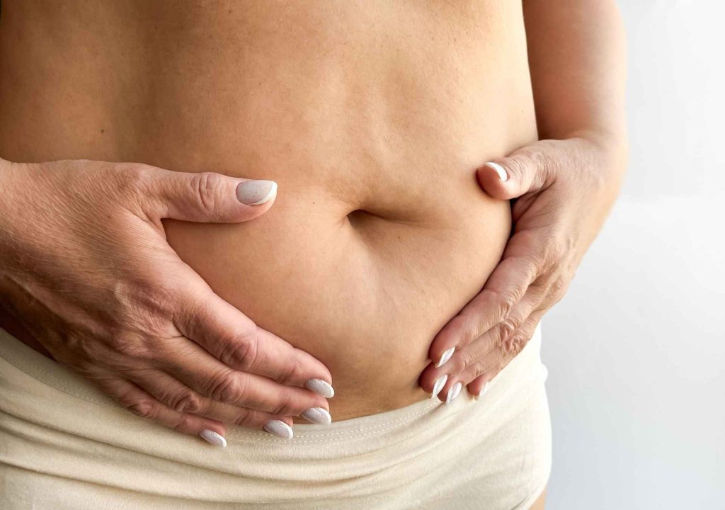 Tratamiento flacidez abdomen post parto sin cirugía