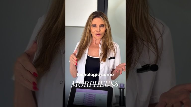 Aplicación de Morpheus8 para tensado facial con radiofrecuencia fraccionada