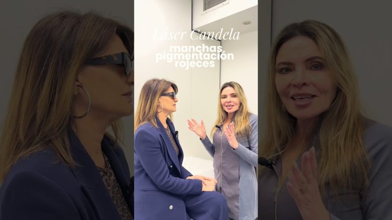 Teresa Calandra, tercera sesión: Morpheus8 y Fraxel para cuello, escote y manos