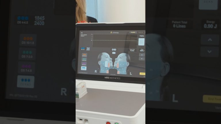 Ultherapy PRIME: precisión en cada disparo para un lifting sin cirugía
